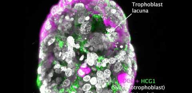 Sciences : Des chercheurs créent un modèle d’embryon humain sans ovule ni sperme