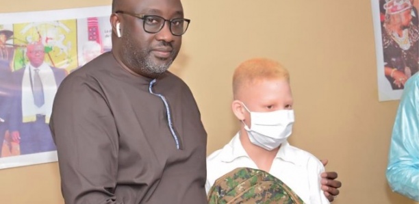 La gratuité de la crème solaire, "une préoccupation majeure" pour les albinos du Sénégal