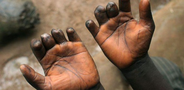 Justice sociale : Macky Sall met fin aux villages de recasement