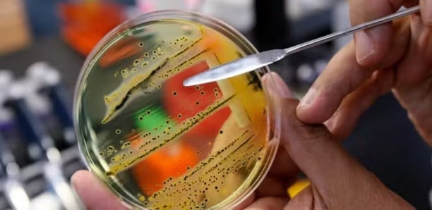 Superbactéries : des millions de morts, un coût de 2.000 milliards de dollars par an d'ici à 2050... Des modèles scientifiques craignent le pire