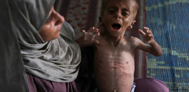 Guerre des mots autour d'un territoire inaccessible: Gaza face au spectre de la famine