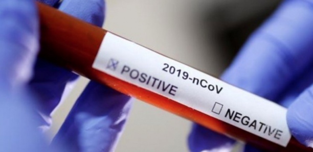 Coronavirus au Sénégal : Le bilan passe de 31 à 36 cas
