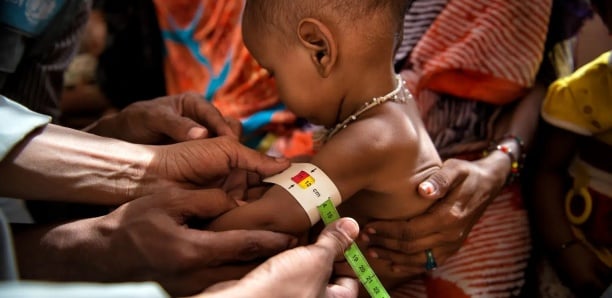 « À six mois, mon enfant ne mangeait plus » : Récits bouleversants sur la malnutrition à Touba (2/2)