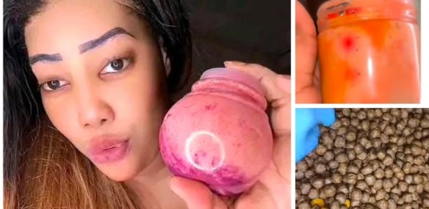 Affaire des boulettes : Bonne nouvelle pour «Alima Suppo»