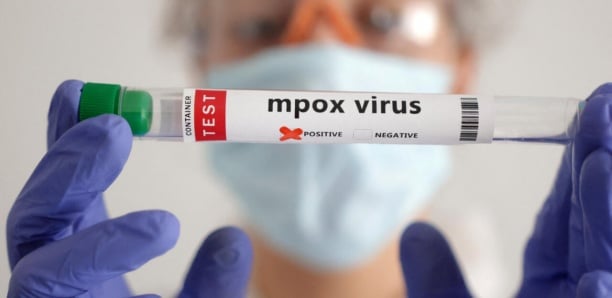 Sierra Leone : Déclaration de l’état d’urgence sanitaire face à une flambée de mpox