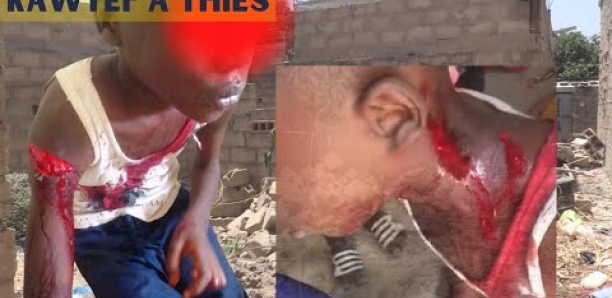 [Video] Thiès : Sauvagement agressé, un garçon de 8 ans a failli être égorgé à Darou Salam