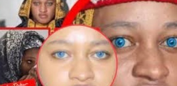 Koukande : “Taxaw Na Ci Kaw Ndox Mi Benin…”