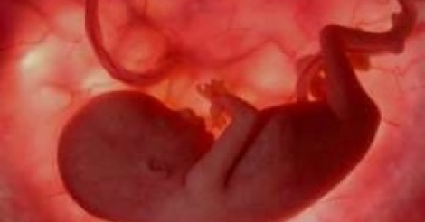 Inde : un foetus retiré du ventre d'un garçon de 4 ans