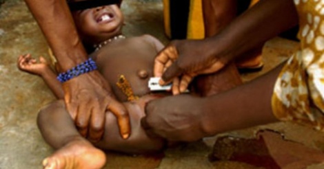EXCISION – Au Sénégal, 14% des filles de moins de 15 ans toujours excisées (Unicef)