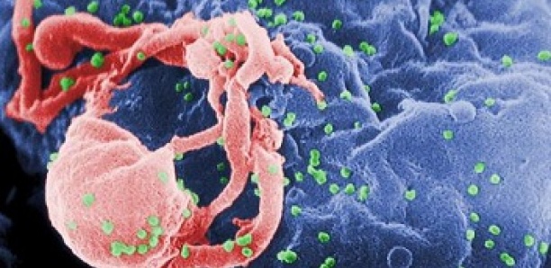 Infection par le VIH, Sida : les premiers signes
