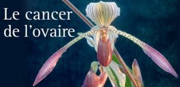 Cancer de l'ovaire : quels sont les symptômes ?